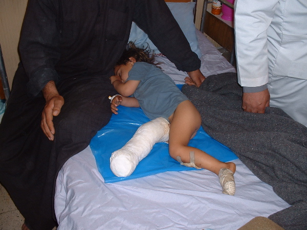 A Lebanese child who lost her leg due to a U.S.-supplied cluster munition in 2006